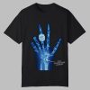 Torn Scapholunate Ligament Shirt 0 0
