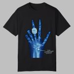 Torn Scapholunate Ligament Shirt