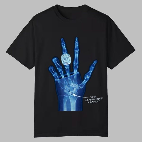 Torn Scapholunate Ligament Shirt 0 0