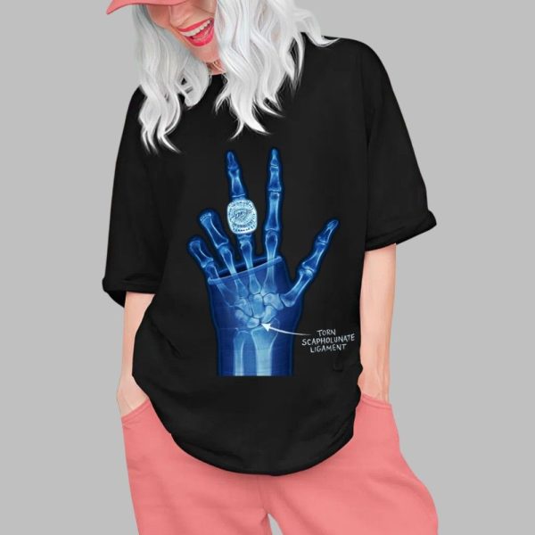 Torn Scapholunate Ligament Shirt 0 1