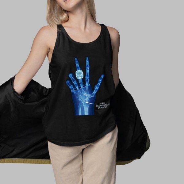 Torn Scapholunate Ligament Shirt 3 1